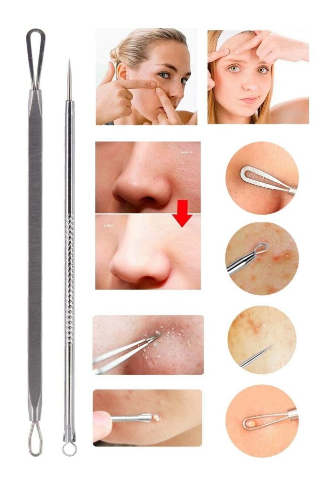 Akne-Siyah Nokta Komedon Temizleyici 8694390465383